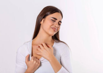 Mujer que le ha picado un mosquito