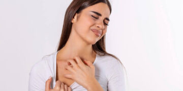 Mujer que le ha picado un mosquito