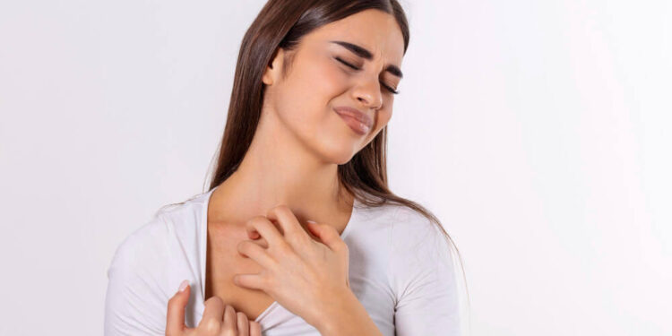 Mujer que le ha picado un mosquito